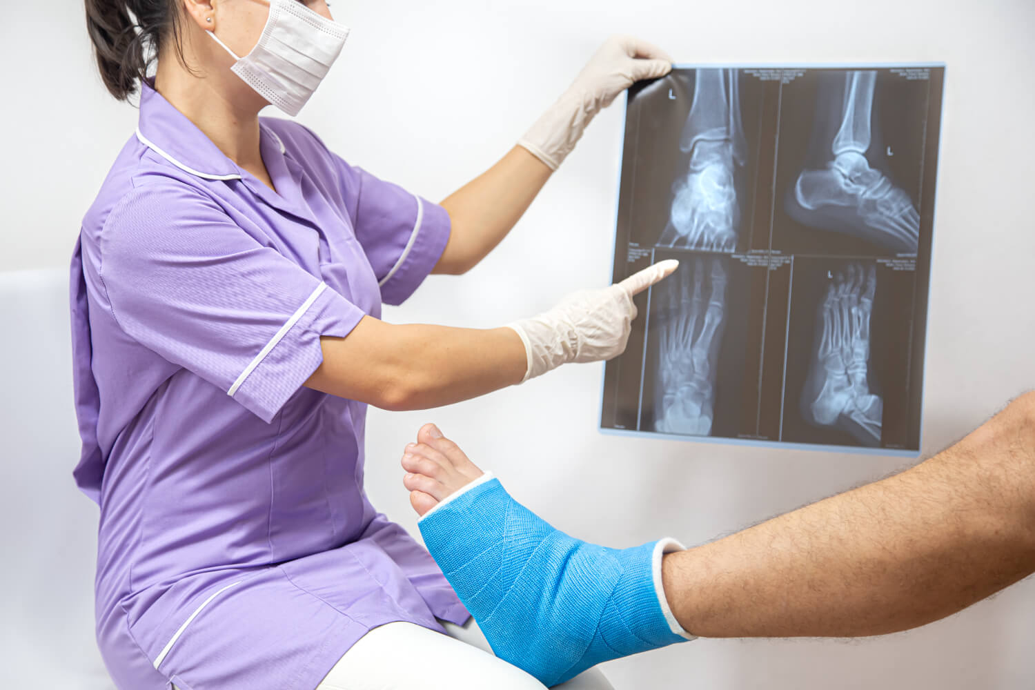 Non-Displaced Ankle Fracture Surgery in New Jersey