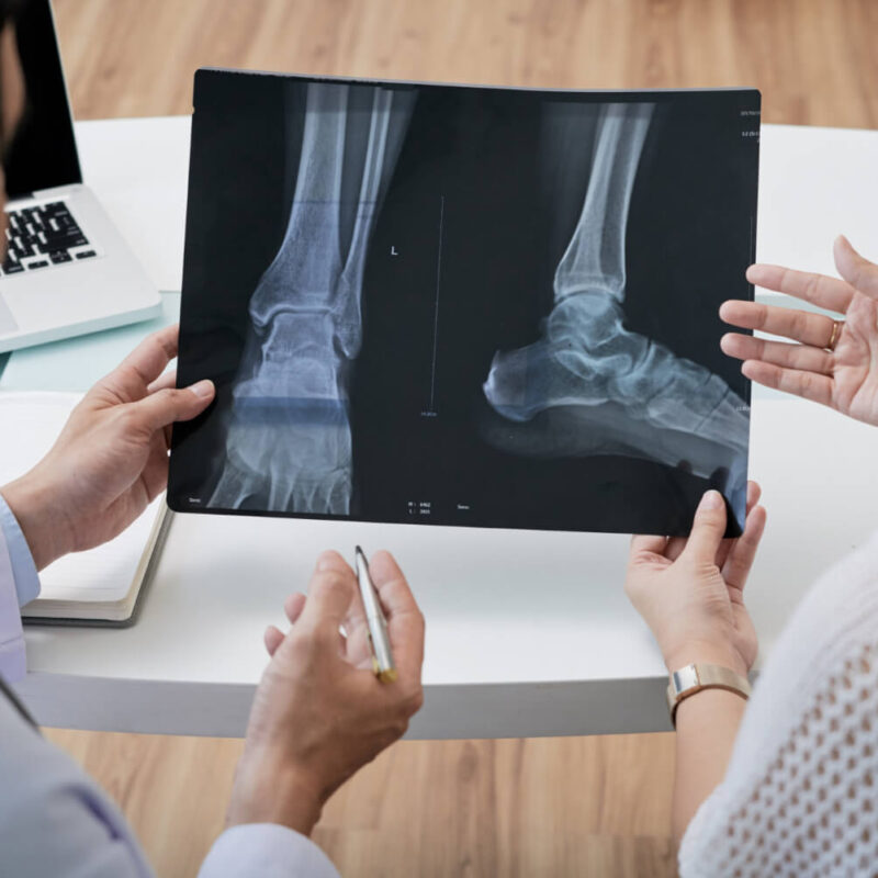 "Struggling with foot pain? Discover expert Triple Arthrodesis Foot Surgery in New Jersey for lasting stability and relief. Book your consultation today!"